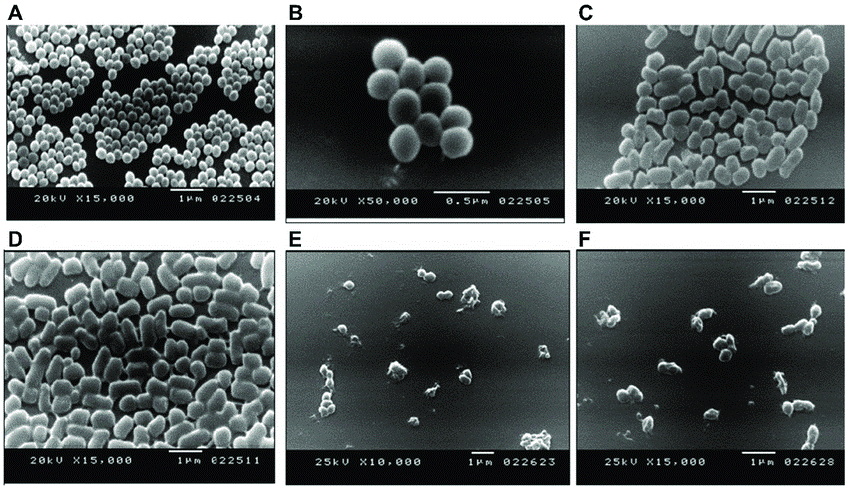 Gambar tampak MRSA