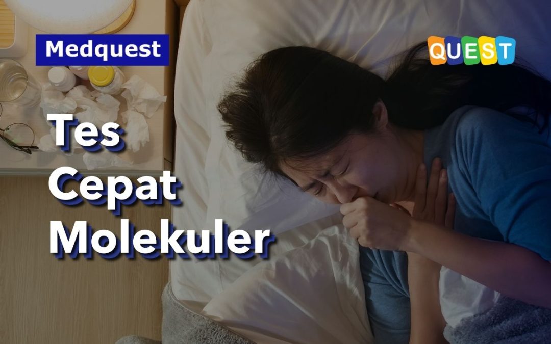 Mengenal Tes Cepat Molekuler (TCM) Pada Pemeriksaan TBC