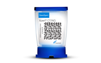 Xpert® CT/NG