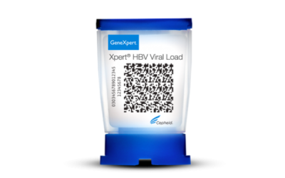 Xpert® HBV Viral Load