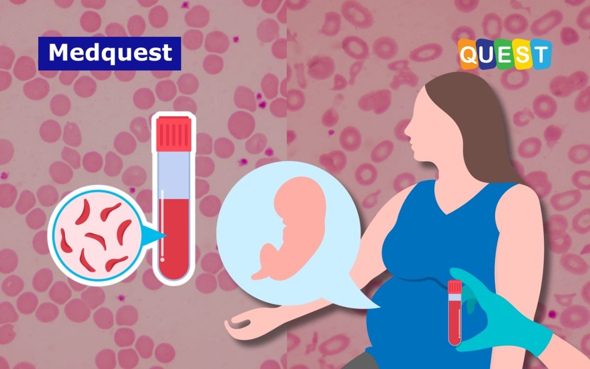 Talasemia: Penyebab, Tipe-Tipe & Penurunan Sifatnya