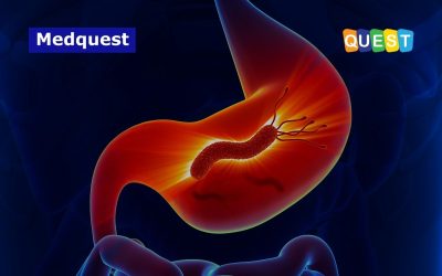 Waspadai Infeksi H. Pylori Pada Lambung: Membahayakan Nyawa!