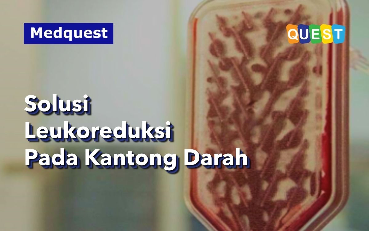 Solusi Leukoreduksi Pada Kantong Darah: LCG2B-LCG4B