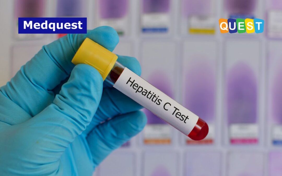 Eradikasi Hepatitis C: Pentingnya Peran Pemantauan RNA HCV