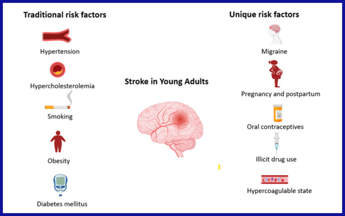 Faktor risiko terjadinya stroke pada usia muda