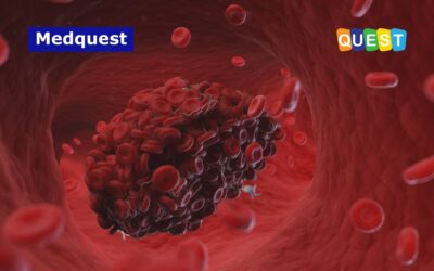 Tromboelastografi: Solusi Praktis dan Efektif Pemeriksaan Fungsi Hemostasis