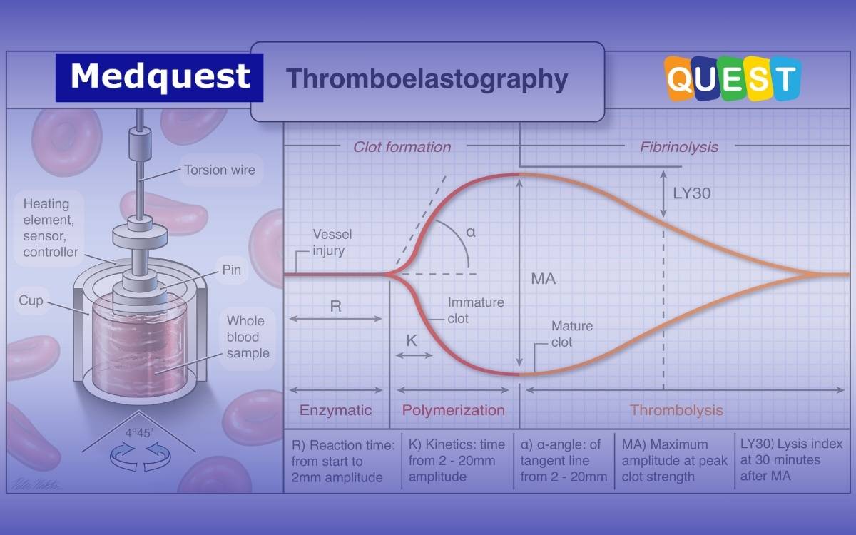 Tromboelastografi (TEG): Peran Penting dalam Manajemen Koagulasi dan Transfusi di Dunia Medis