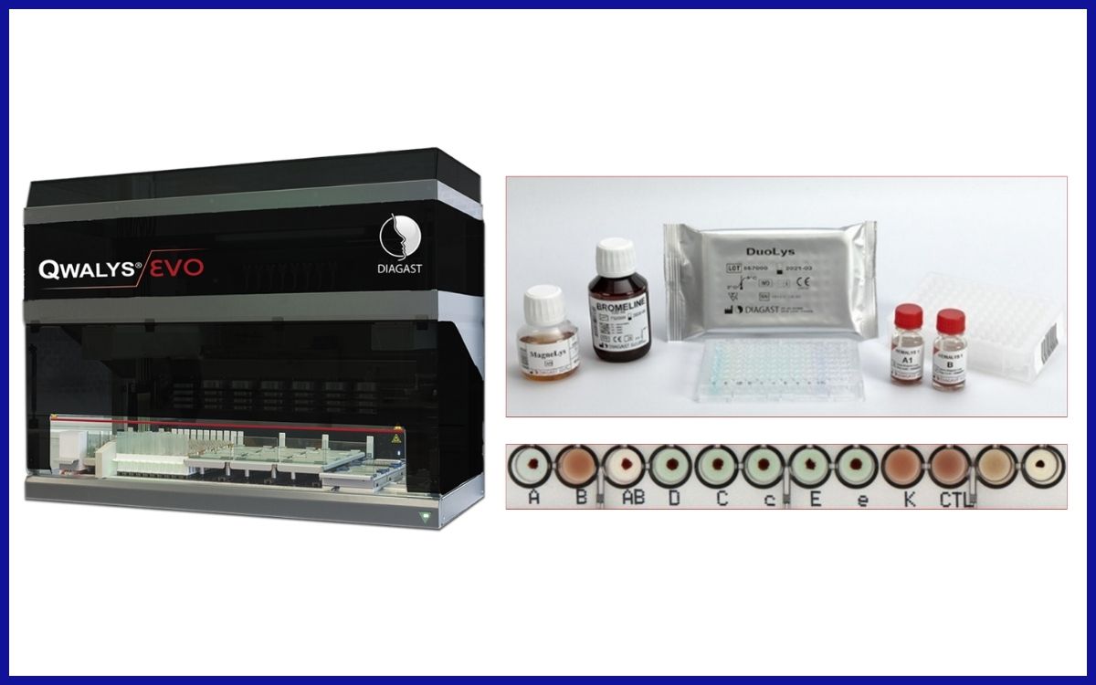 Diagast QWALYS® 3 EVO & Diagast DuoLys