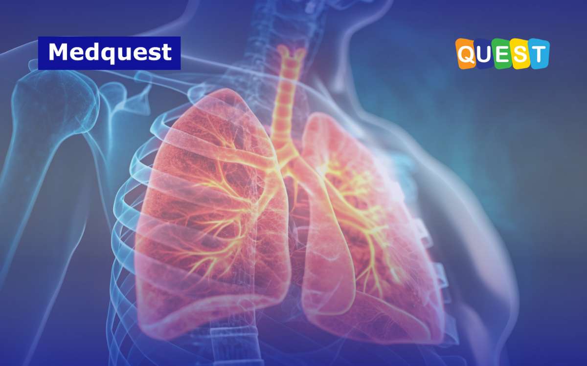 Lonjakan Kasus ISPA di Indonesia 2025: Fakta di Balik Isu Flu Singapura