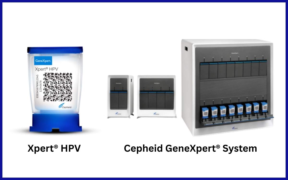 Tes Cepat Molekuler (TCM) Deteksi HPV